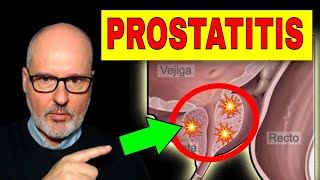 PROSTATITIS AGUDA y CRÓNICA Síntomas Causas y Tratamiento [upl. by Arikihs201]