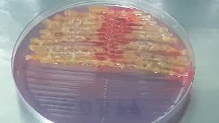 Serratia fonticola on CLED Agar Uropathogen [upl. by Dene]