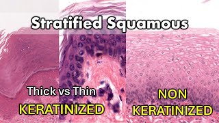 Keratinized vs Non Keratinized Thick vs Thin [upl. by Ainaj]