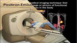 PET Positron Emission Tomography [upl. by Johppah220]