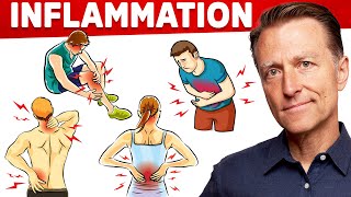 The 1 Best Remedy for Inflammation Autoimmune Gut and Arthritis That You Never Considered [upl. by Salzhauer71]