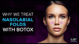 Using BOTOX® To Treat Nasolabial Folds at Mabrie Facial Institute [upl. by Haimerej]