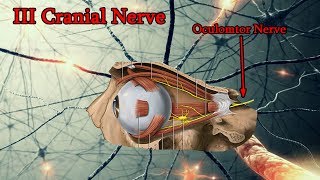 Oculomotor Nerve Palsy III Cranial Nerve palsy Medical animation [upl. by Kado]