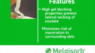 Benefits of Molnlycke Melgisorb Ag Calcium Alginate Dressing [upl. by Frederich]