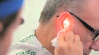 Ear Irrigation with a Propulse NG Ear Irrigatorwmv [upl. by Nilyarg449]