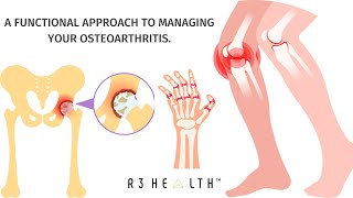 Diagnosed with Arthritis R3 Health Can Help [upl. by Enileve105]