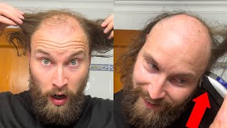 BALDING MAN Has INSANE Shave MAKEOVER [upl. by Si]