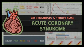 12 DIAGNOSIS DAN TERAPI SINDROM KORONER AKUT 2 ISCHEMIC HEART DIASEASE [upl. by Hamforrd]