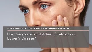 How can you prevent Actinic Keratoses and Bowens Disease [upl. by Marcelle904]