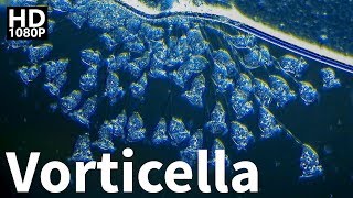 Vorticella Under Microscope [upl. by Ardnasyl233]