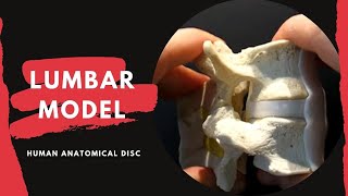 Lumbar Spine Anatomy Model  with Ligamentum Flavum and Interspinous Ligament [upl. by Vassell947]