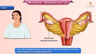 Menopause Symptoms  Ways to Deal With it [upl. by Nema]