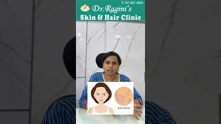 How to Identify Psoriasis Key Symptoms amp Tips  Understanding Psoriasis 🩺✨  Dr Ragini [upl. by Leamse159]