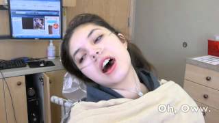 Cutest Wisdom Teeth Removal Video Ever Hannah after wisdom teeth removal Must watch [upl. by Nirok]