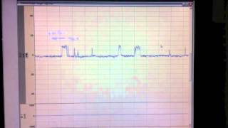 BKCa Single channel recording [upl. by Kliman829]