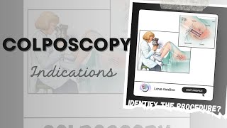 What is colposcopy  The diagnostic procedure Colposcope  Indication of colposcopy in tamil [upl. by Sybyl]