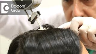 What is the role of Mesotherapy in hair loss  Dr K Prapanna Arya [upl. by Inirt]