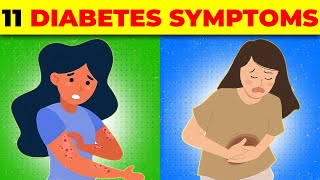 11 Early Signs of Diabetes You Should KnowFIT amp HEALTHihealth11 Early Signs [upl. by Corneille]