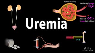 Uremia Pathophysiology Symptoms Diagnosis and Treatment Animation [upl. by Haberman]