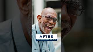 He Got A NEW Smile In Just 24 Hours 🤯 Permanent Teeth Transformation ✨ shorts [upl. by Plotkin]