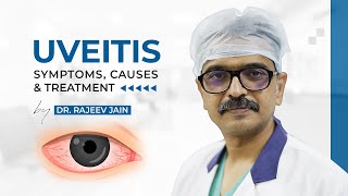 Uveitis  Causes Signs Symptoms Diagnosis amp Treatment  Dr Rajeev Jain  Delhi Best Eye Hospital [upl. by Goodard]