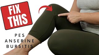 Pes Anserine Bursitis Knee  Treatment amp Exercise to Reduce Pain [upl. by Mathilda]