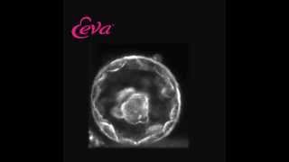 Embryo Development Day 5 Using The Eeva Test [upl. by Kopans]