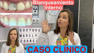 Blanqueamiento Interno  CASO CLÍNICO  Lo que no debes hacer  65 [upl. by Sucramaj]