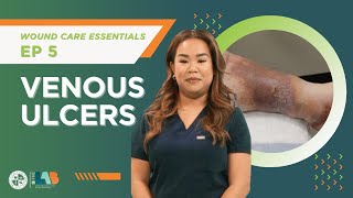 Wound Care Essentials Video 5 – Venous Ulcers [upl. by Fausta477]