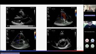 RV Assessment [upl. by Vig]