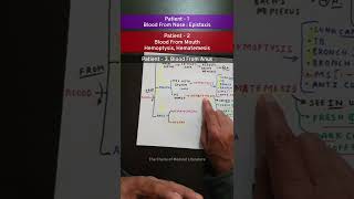 Epistaxis Hematemesis Hemoptysis Hematochezia Melena tcml shorts mbbs [upl. by Materi]