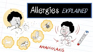 What are Allergies HealthSketch [upl. by Naerb]