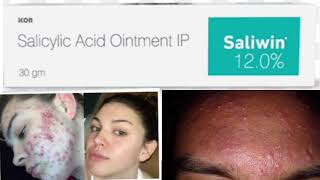 Saliwin 120 ointment Salicylic Acid Ointment IP [upl. by Enihpets808]