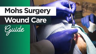 Caring for Your Wounds after Mohs Surgery A Guide for Patients [upl. by Kimberlyn]