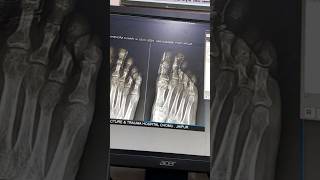 xray technique xray xraytechnician vlog [upl. by Yuk]