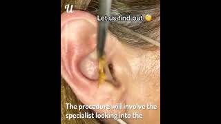 ENT doctor remove ear wax Discover popular [upl. by Messing]