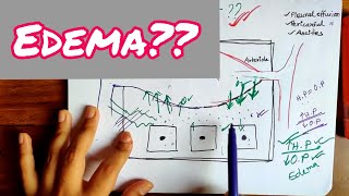 Edema  Physiology of Edema  Mechanism of Edema  Bangla Demonstration of Edema  Edema Physiology [upl. by Bevin]