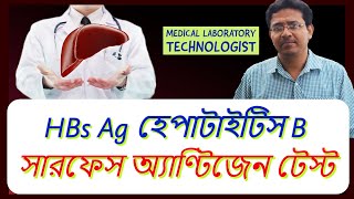 HBsAg Hepatitis B Surface Antigen Test  HBs Ag হেপাটাইটিস বি সারফেস অ্যাণ্টিজেন টেস্ট [upl. by Xantha]