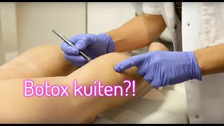 Kuiten smaller maken met botox  FURROWNL [upl. by Jak]