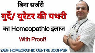 Kidney ureter stone Homeopathic treatment without surgery गुर्दे की पथरी का ईलाज बिना ऑपरेशन । [upl. by Yajet]