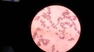 Staphylococcus haemolyticus [upl. by Ranice]