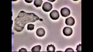 Neutrophil Phagocytosis  White Blood Cell vs Staphylococcus Aureus Bacteria [upl. by Evita405]