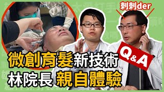 毛囊自體微移植技術 AMT，微創育髮治療雄性禿，林政賢院長親自體驗！楊省三醫師幫你解答 Regenera Activa RA 所有 Q amp A [upl. by Eelessej]