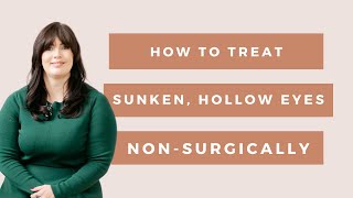 How to Treat Sunken and Hollow Eyes Non Surgically [upl. by Ru]