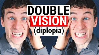 What Causes DOUBLE VISION Diplopia  5 Common Causes for Diplopia  Doctor Eye Health [upl. by Ahsinhoj]