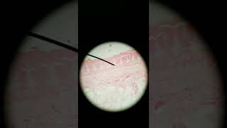 Meissners and Pacinian corpuscle histology [upl. by Redneval]