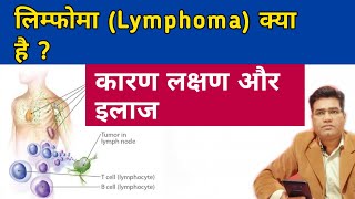 What is Lymphoma  its Cause Symptoms and Treatment [upl. by Hamimej]