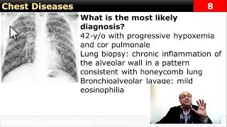 Chest case What is your diagnosis internalmedicine cme usmle محاضراتباطنة كورساتباطنة [upl. by Reivazx529]