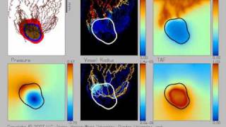 Simulation of tumour growth and angiogenesis [upl. by Kcirret444]