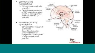 Fetal Hydrocephalus [upl. by Ycak]